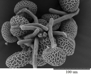Scanning electron micrograph of pollen grains