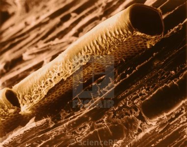 Microscopic view of a xylem vessel