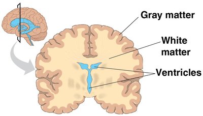 Cross-section of the brain showing gray matter, white matter, and ventricles
