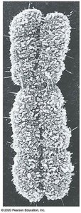 Electron micrograph of a chromosome