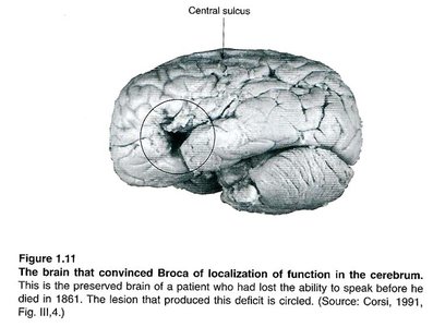 Brain showing Broca's and Wernicke's areas