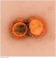 Electron micrograph of virus particles
