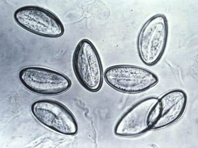 Pinworm eggs