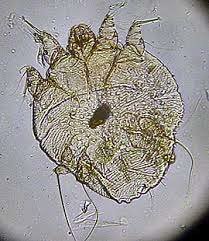 Sarcoptid mite (microscopic image)