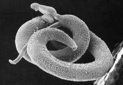 Schistosoma mansoni, the blood fluke