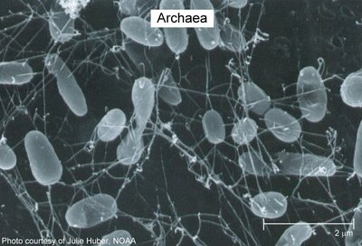 Electron micrograph of Archaea