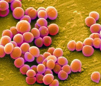 Methicillin-resistant Staphylococcus aureus (MRSA)