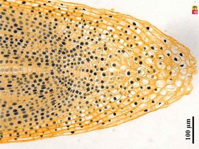 Onion root cells (plant cells)