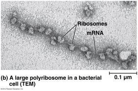 Polyribosome in bacterial cell (TEM)