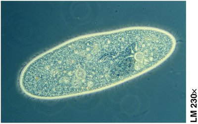 Light micrograph of Paramecium