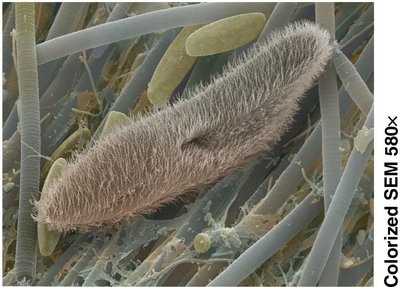 Scanning electron micrograph of Paramecium