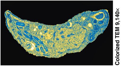 Transmission electron micrograph of Toxoplasma
