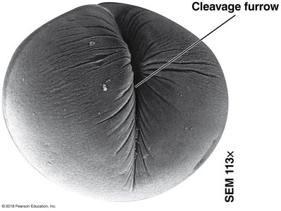 Contracting ring of microfilaments in cytokinesis