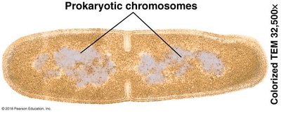 Prokaryotic cell with chromosomes