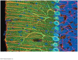 Micrograph showing glial cells and neuron cell bodies
