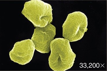 Sulfolobus, an archaean