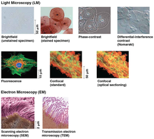Examples of SEM and TEM images