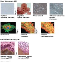 Types of light and electron microscopy