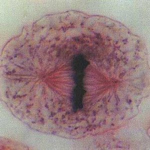 Metaphase in mitosis