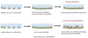 Contact inhibition: normal vs. cancer cell growth in culture