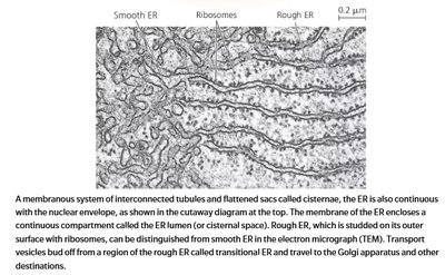 Electron micrograph of ER showing smooth and rough regions, ribosomes, and cisternae