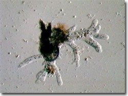 Amoeba with pseudopodia