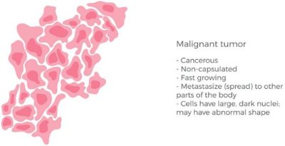 Benign tumor: non-cancerous, localized
