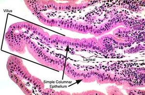 Simple columnar epithelium in villus