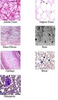 Various types of connective tissue