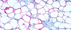 Adipose tissue