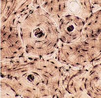 Microscopic structure of bone tissue