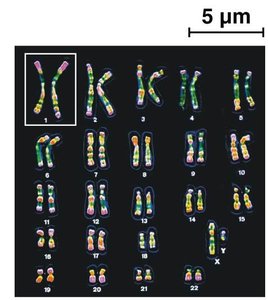 Human karyotype showing autosomes and sex chromosomes