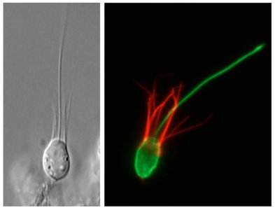 Choanoflagellate micrographs