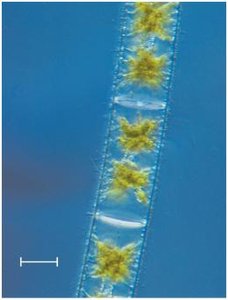 Microscopic view of green algae