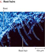Parenchyma tissue with labeled cell walls, vacuole, and nucleus