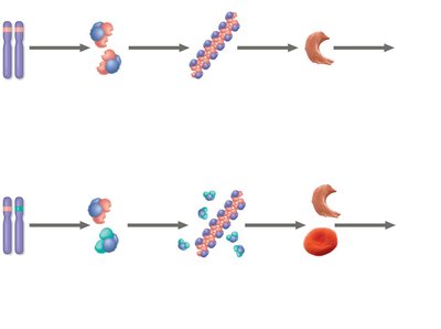 Sickle-cell disease and trait