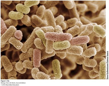 Prokaryotic cells