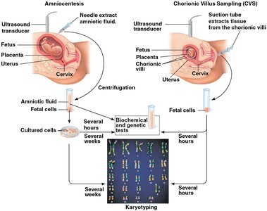 Fetal Testing (Amniocentesis and CVS)