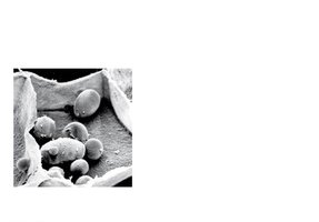 Storage structures containing starch granules in a potato tuber cell