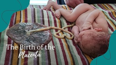Human newborn with placenta, example of placental birth