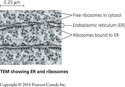 TEM showing ER and ribosomes