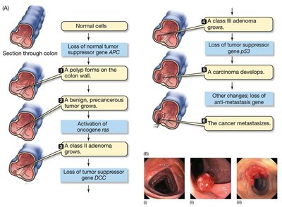 Progression of genetic changes in cancer