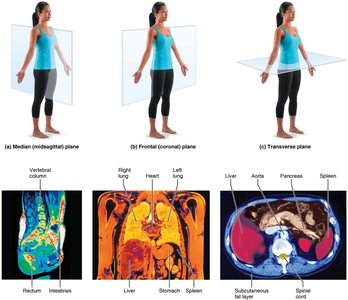 Body planes with MRI scans