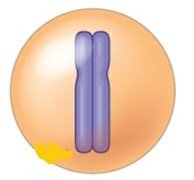Diagram of a chromosome with two sister chromatids