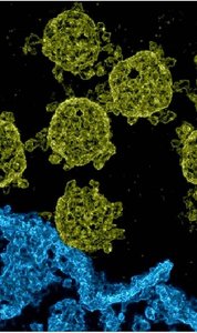 viruses infecting E. coli cell
