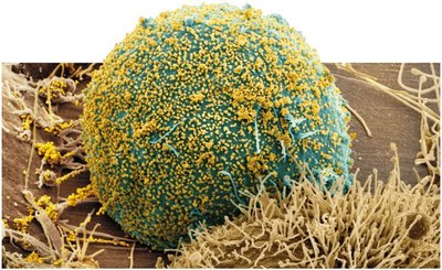 HIV virus infecting a human immune cell
