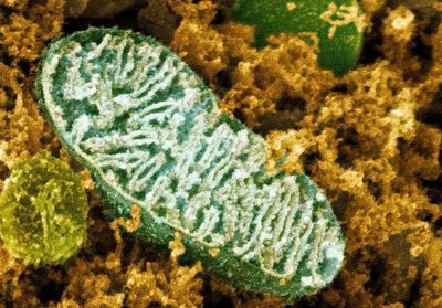 Electron micrograph of mitochondrion