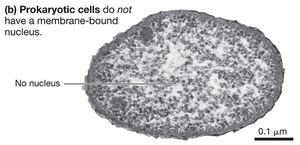 Prokaryotic cell without a nucleus