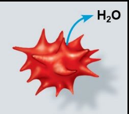 Animal cell in hypertonic solution