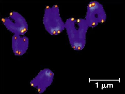 Fluorescent image of chromosomes with telomeres stained orange